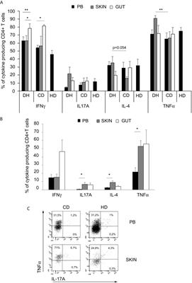 T Cell Response Toward Tissue-and Epidermal-Transglutaminases in Coeliac Disease Patients Developing Dermatitis Herpetiformis